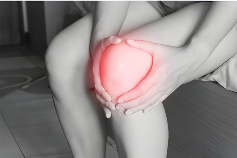 Knee Pain Physiotherapy ​